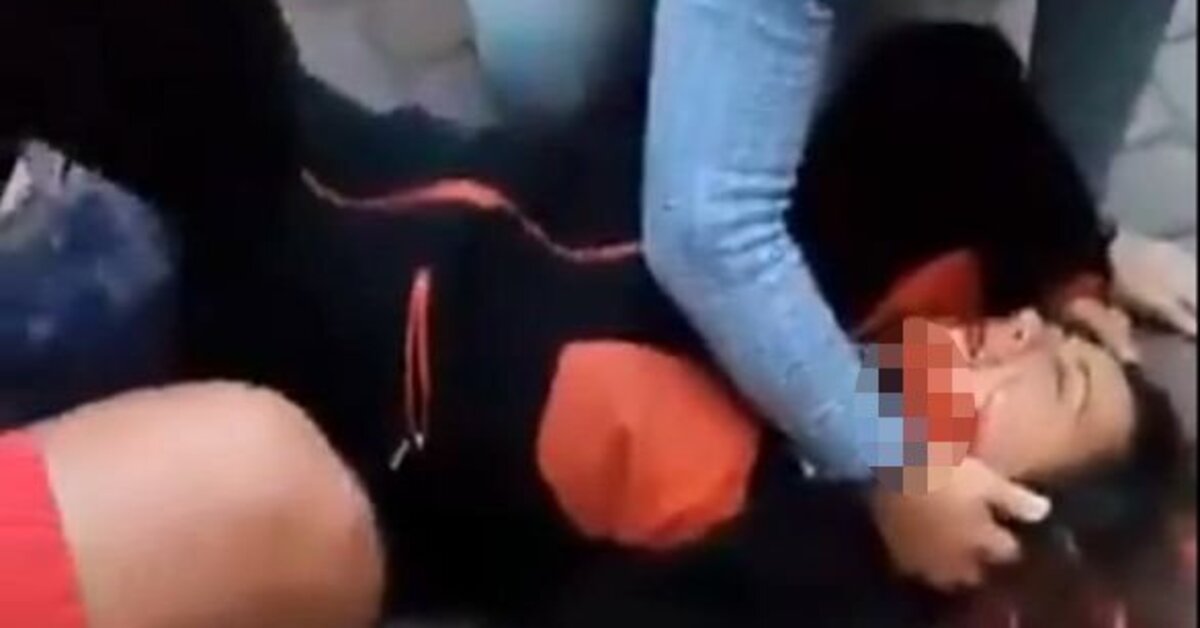 Profesör köpeklerin saldırısında yaralandı