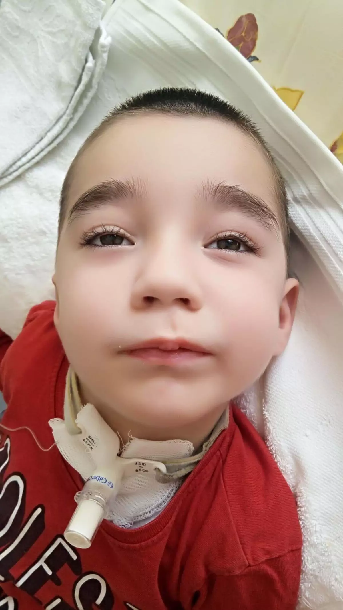 İzmir’de Anestezi Hatası Sonucu Engelli Olan Çocuk Hayatını Kaybetti